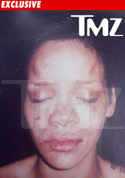 rihanna pictures after beating tmz. TMZ posted a leaked photo of